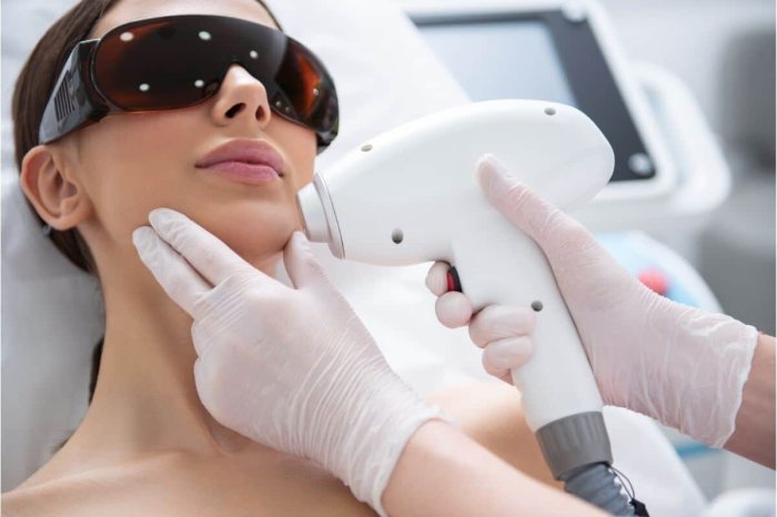Laser skin treatment near me